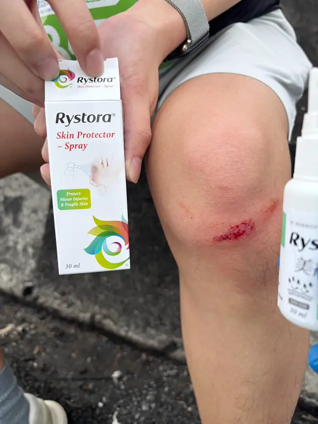 美得膚傷口噴霧 應用於活動現場淺層擦傷照護